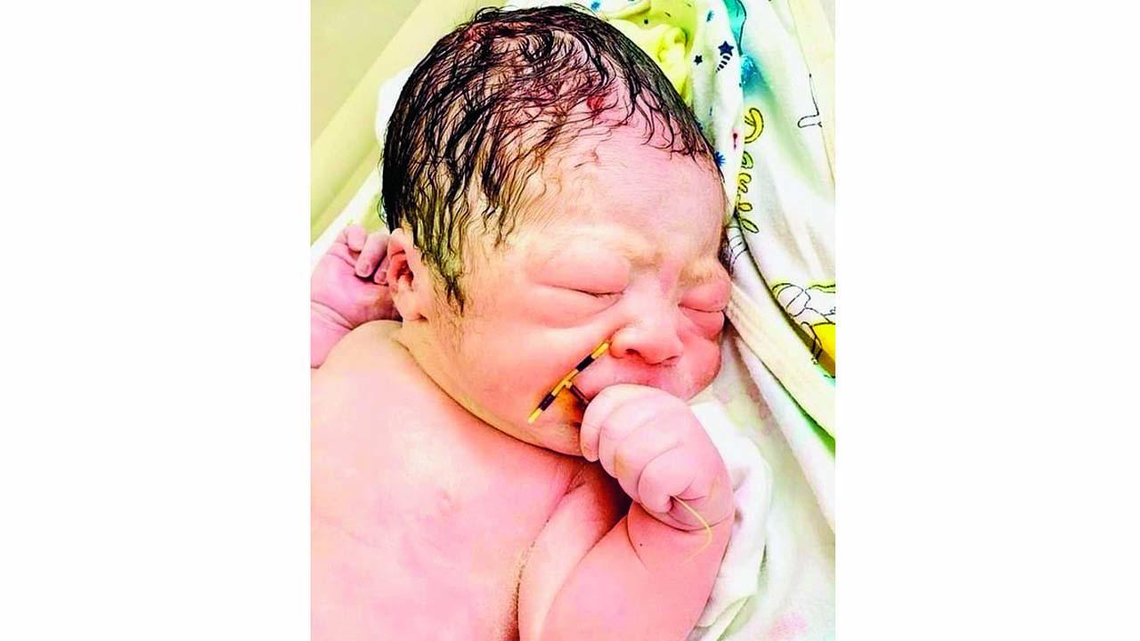 ડૉક્ટરે બાળકનો એવો ફોટો પાડીને સોશ્યલ મીડિયા પર શૅર કર્યો